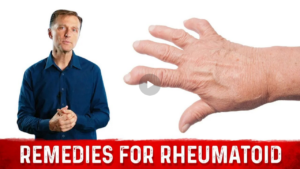 Best Remedies for Rheumatoid Arthritis