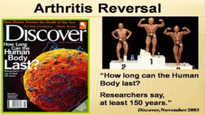Updated How to Reverse Arthritis